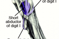 Dogs Dewclaws, should we remove them? …